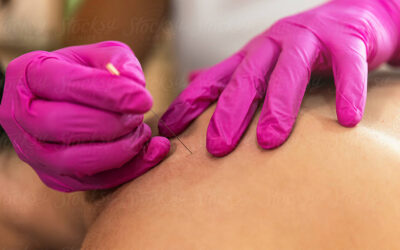 Acupuncture & Cardiology
